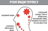 Від запалення мозку судомить і нудить