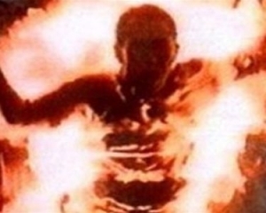 На Житомирщині 78-річна бабуся намагалася себе спалити