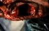 Жорстоке самогубство: мешканець Донеччини відрізав собі голову бензопилою