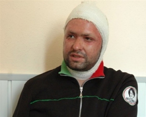 Суд амнистировал Котова, который облил кислотой лицо экс-вице-губернатора Киевщины