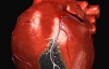 Вчені знайшли спосіб змусити тканини міокарда самовідновлюватися після інфаркту
