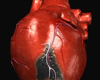 Ученые нашли способ заставить ткани миокарда самовосстанавливаться после инфаркта