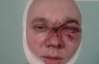 Посетителя криворожского ночного клуба избивали 7 охранников: парню пробили череп и выбили глаз