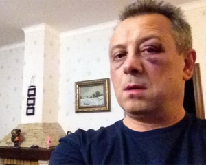 "Сейчас со мной все ок, легкое сотрясение мозга и новая физиономия" ??- двое неизвестных избили "ударовца"
