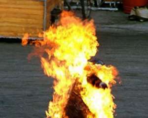 В Черкасской области парень пытался сжечь себя и получил 80% ожогов кожи