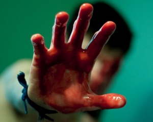 В Танзании мальчику-альбиносу по дороге в школу неизвестные отрезали руку