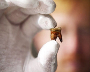Зуби мудрості є побічним ефектом еволюції людини