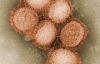 У мешканця Тернополя виявили збудник свинячого грипу
