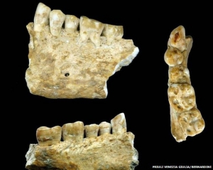 Найдавніший запломбований зуб був виявлений в Словенії
