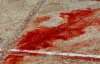 Трагедія в кримському санаторії: кров загиблої дівчинки змивали інші діти