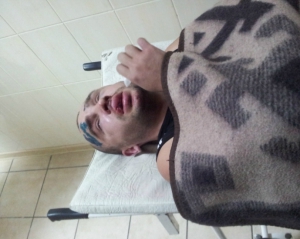 В Донецкой области избили двух борцов с гаишниками, пострадавшие подозревают "Беркут"