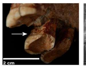 Неандертальцы пользовались зубочистками
