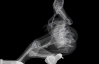 Соблазнительные модели на рентгеновских снимках не теряют своей сексульности