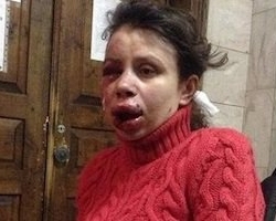 ЗМІ: Столичні мажори побили Чорновол, бо вона таранила їхню автівку