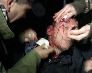 У день сутичок з "Беркутом" у крові Луценка був алкоголь - головлікар