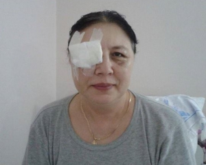 Жінка втратила зір після того, як її побив &quot;Беркут&quot;