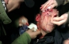 В МВС ответили на видео избиения Луценко: закон позволяет бить людей