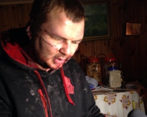 К Булатову в больницу никого не пускают, милиция опрашивает родственников активиста