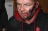 "Мне порезали лицо, обещали выколоть глаз, отрезали кусок уха" - Булатов рассказал о пытках над ним