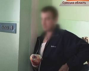 На Сумщині молодику петардою відірвало пальці