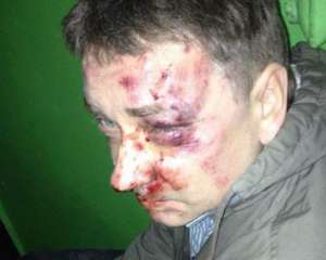 Організатора сумського Майдану жорстоко побили у власному гаражі