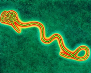Американський лікар підхопив Еболу