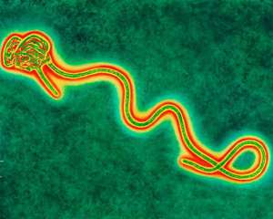 Американский врач подхватил Эболу