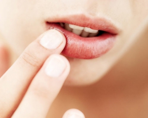 Как избавится от сухости губ: 5 самых действенных средств