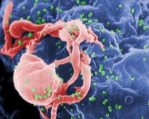 Ученые нашли антитело, подавляющее ВИЧ-инфекцию