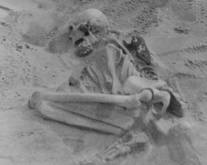 Люди болели рахитом еще 5000 лет назад - ученые