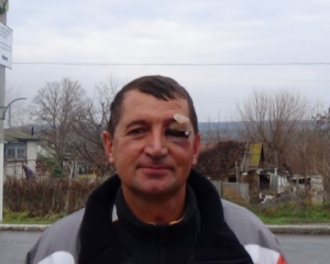 На Вінниччині  невідомі розбили активісту голову