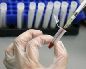 У США зафіксовано перший випадок зараження вірусом Зіка від людини