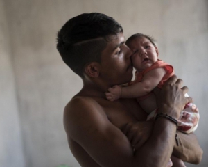 Медики виявили вірус Зіка в сечі і слині