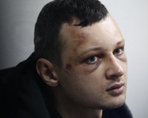 Станислав Краснов за 11 дней голодовки потерял 10 килограм