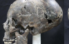 В Южной Корее нашли женщину со странным черепом