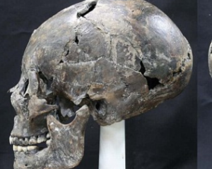 В Южной Корее нашли женщину со странным черепом