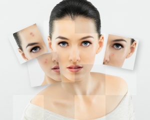 Как очистить лицо от шрамов: четыре домашних способа
