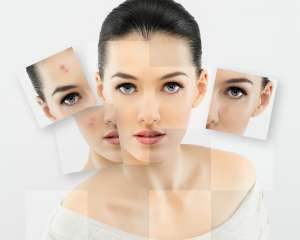 Як очистити обличчя від шрамів: чотири домашніх способи