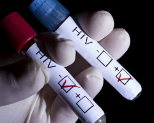 Вперше в історії медики вилікували чоловіка від ВІЛ