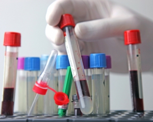 Антибиотики от сифилиса дают через каждый час