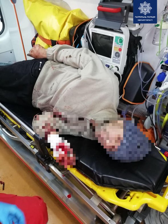 В Одесі   35-річний чоловік серед вулиці порізав собі вени й стікав кров’ю