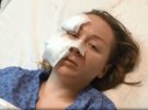 В Турции украинке 28-летней Анне Бутым муж  45-летний Месут Озтюркмен порезал лицо. Напал в торговом центре при свидетелях