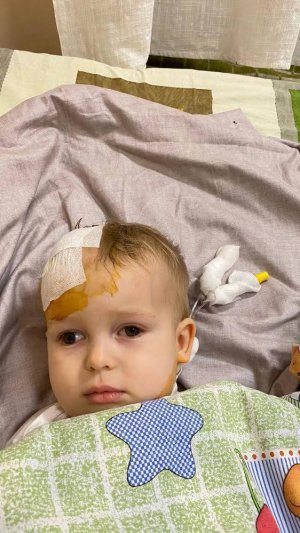 2-річний Макар Кириченко з Києва в двомісячному віці боровся з раком сітківки правого ока.  А на початку січня в дитини виявили рак головного мозку.  