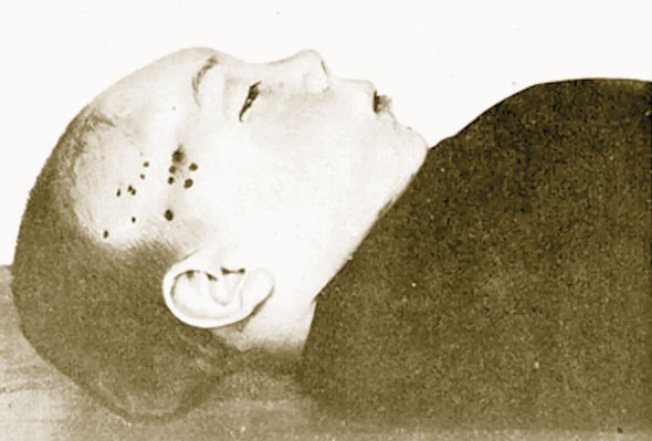 13-річного Андрія Ющинського знайшли мертвим у Києві 20 березня 1911-го. Виявили 47 колотих ран. Поховали на Лук’янівському цвинтарі