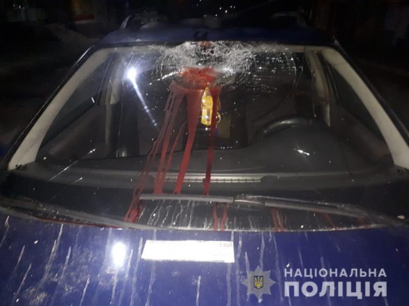 Пішохід отримав важкі травми  та  госпіталізований у реанімаційне відділення лікарні