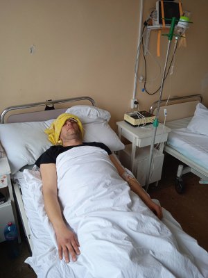 У 39-летнего Алексея Сенько из Черкасс обнаружили кровоизлияние в головной мозг, субарахноидальное кровоизлияние и большую аневризму. На операцию в столичной клинике нужно 150 тыс.грн.