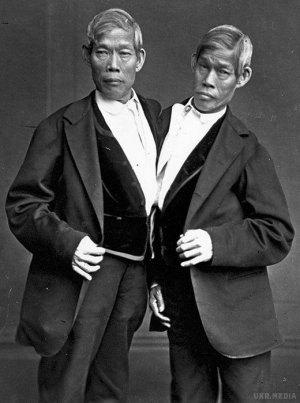 Первые сиамские близнецы Чанг и Энг прожили 63 года и имели 2 семьи