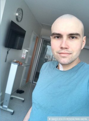 24-летний Антон Михайлюк из города Помошная Кировоградской области лечит лимфому Ходжкина. После пересадки костного мозга требует сложной реабилитации. Родные просят помощи.