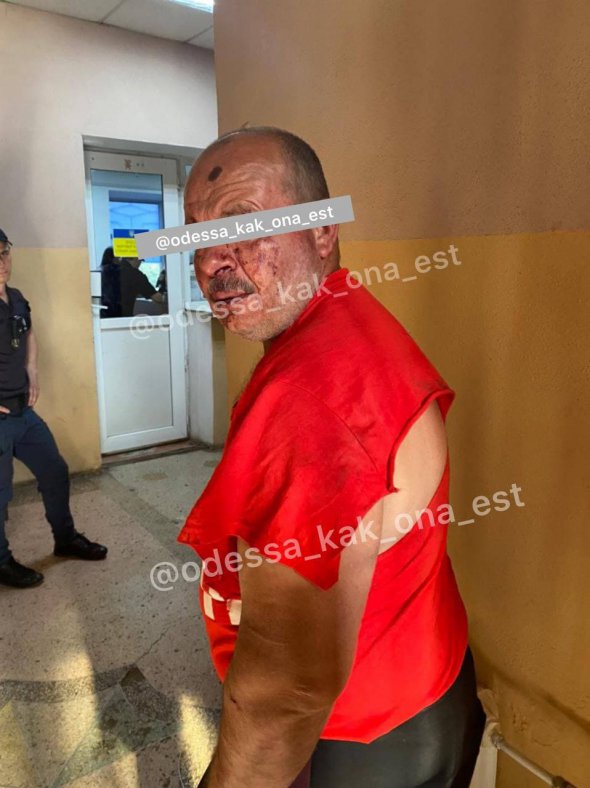 В Одессе мужчина напал на больную девушку и попал под самосуд прохожих