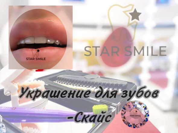 В студии Star Smile можно выбрать скайс на зуб различных фирм и цветов
